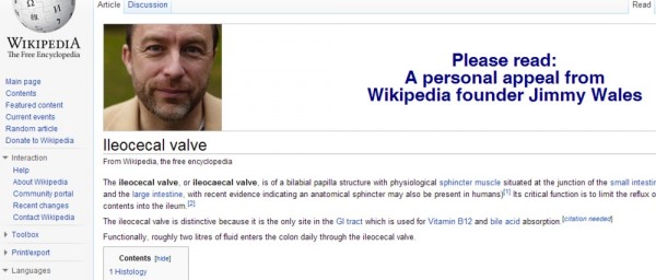 Ileocecal_valve_wikipedia_the_